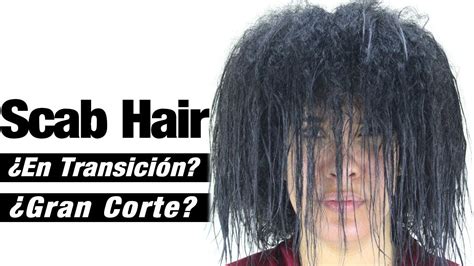 pelo ensortijado causas|Orphanet: Enfermedad del cabello ensortijado